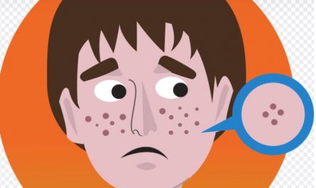 Dreaming about pimples: 6 main meanings to explain