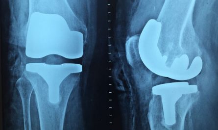 Dreaming about taking X-rays