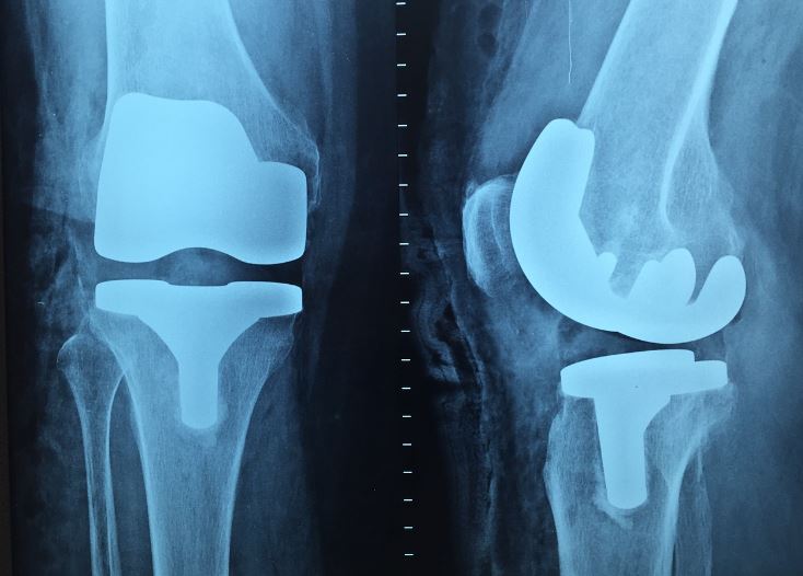 Dreaming about taking X-rays: 4 main meanings explained