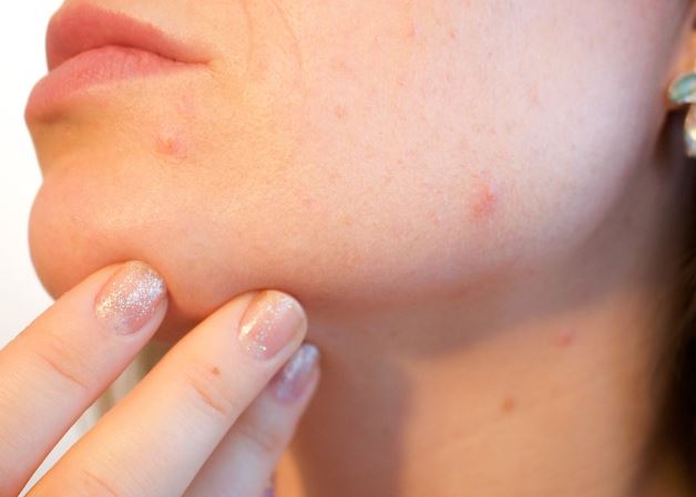Dreaming about acne: 6 main meanings explained