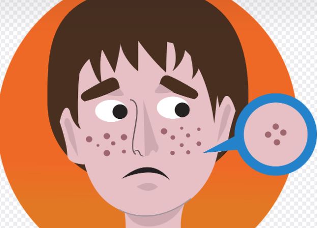 Dreaming about pimples: 6 main meanings to explain
