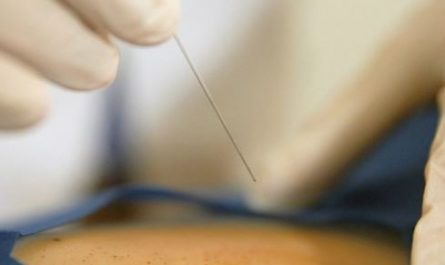 Dream about being stabbed in the body: 5 Main Meanings Explained