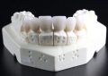 Dream about dentures : 26 Main Meanings Explained