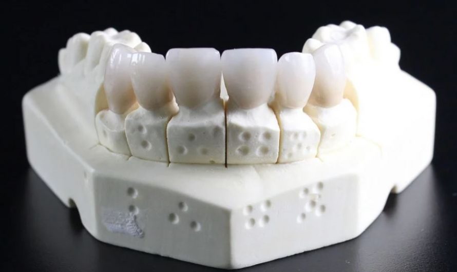 Dream about dentures : 26 Main Meanings Explained