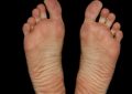 Dream about rotten feet : 13 Main Meanings Explained