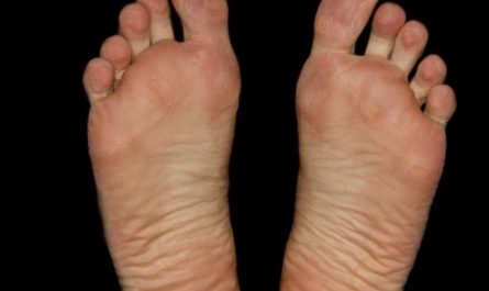 Dream about rotten feet : 13 Main Meanings Explained