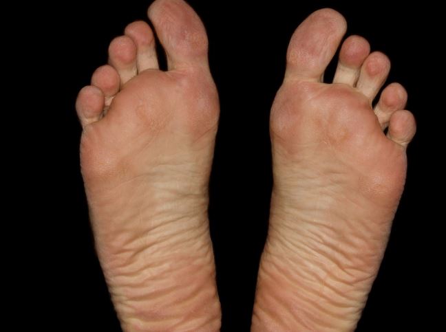 Dream about rotten feet : 13 Main Meanings Explained