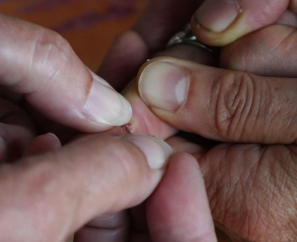 Dreaming of Blisters: 13 Meanings and Symbolisms